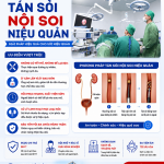 TÁN SỎI NỘI SOI NIỆU QUẢN – GIẢI PHÁP HIỆN ĐẠI CHO NGƯỜI BỆNH SỎI TIẾT NIỆU